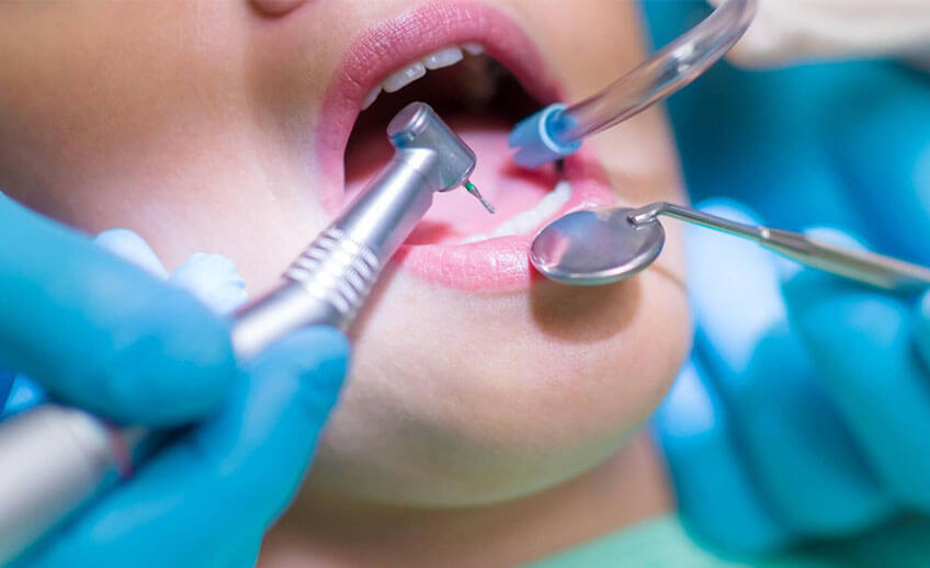 Oralna hirurgija i zahvati